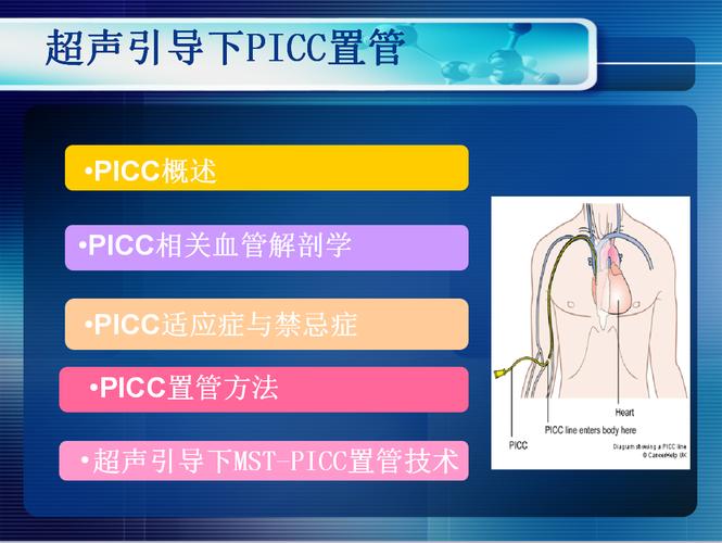 picc是什么意思-picc是什么意思醫(yī)學上面