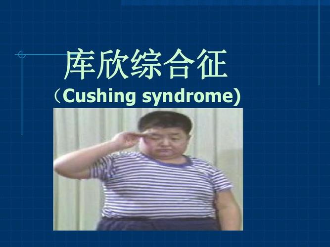 syndrome-syndrome怎么記憶