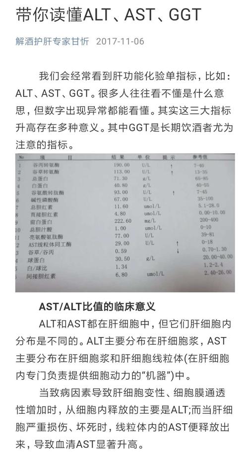 alt-alt和ast偏高的原因